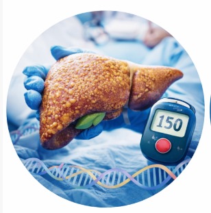Metabolic Dysfunction–Associated Fatty Liver Disease (MAFLD)